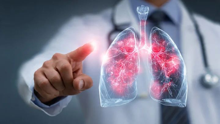 Doctor pointing at digital lungs showing damage linked to Asbestlint exposure